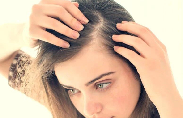 How to Avoid Traction Alopecia When Wearing Hair Toppers