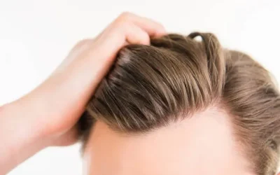 Men Hair Patches